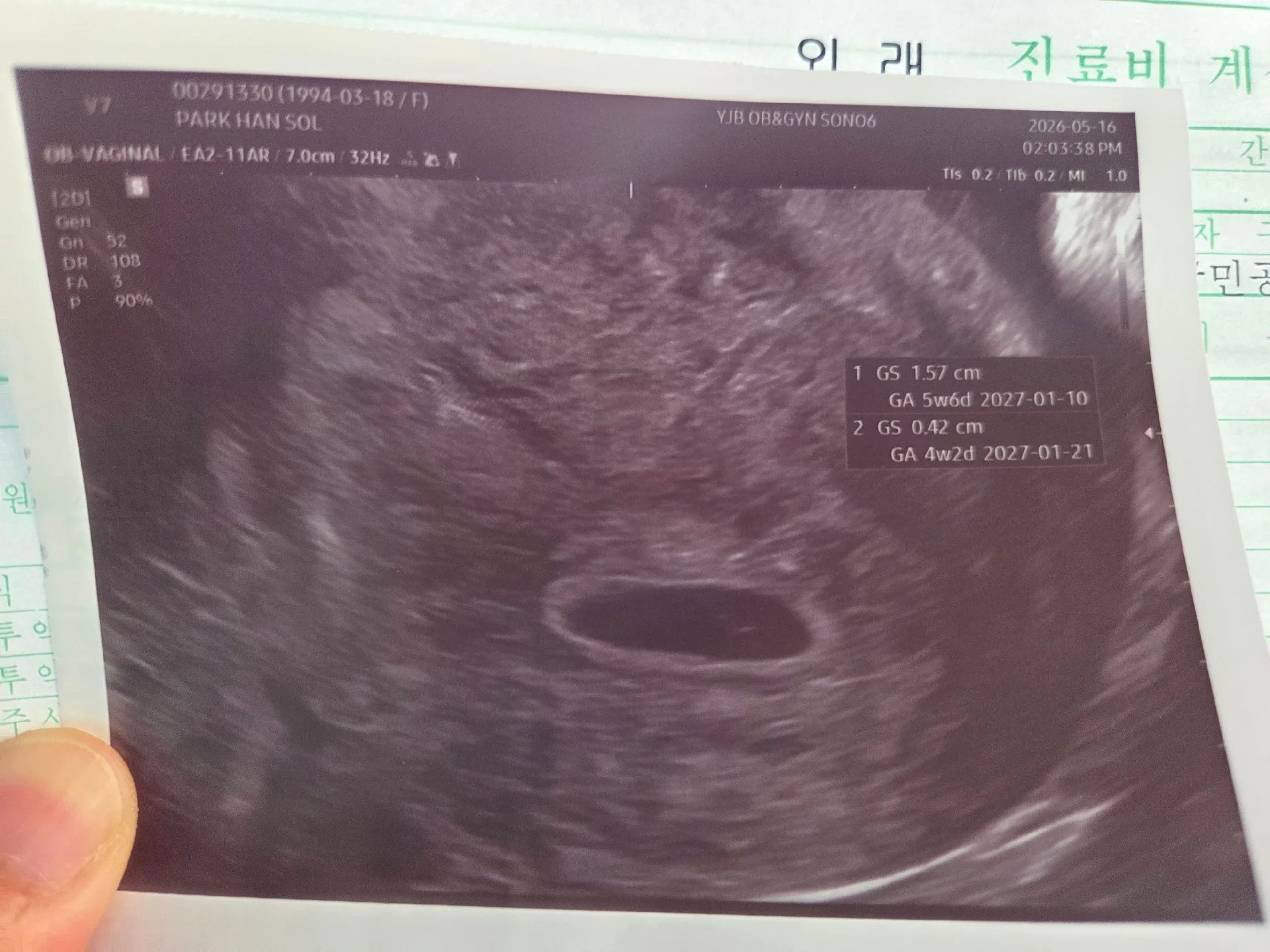 초음파 봐주세요!