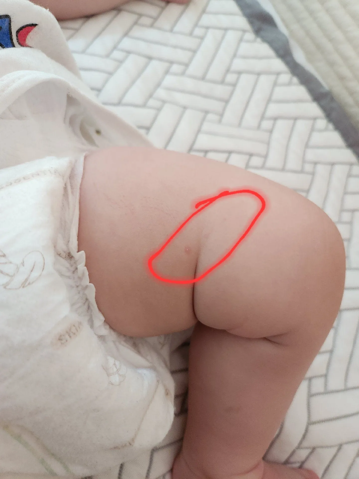 수족구 일까요??!? 2