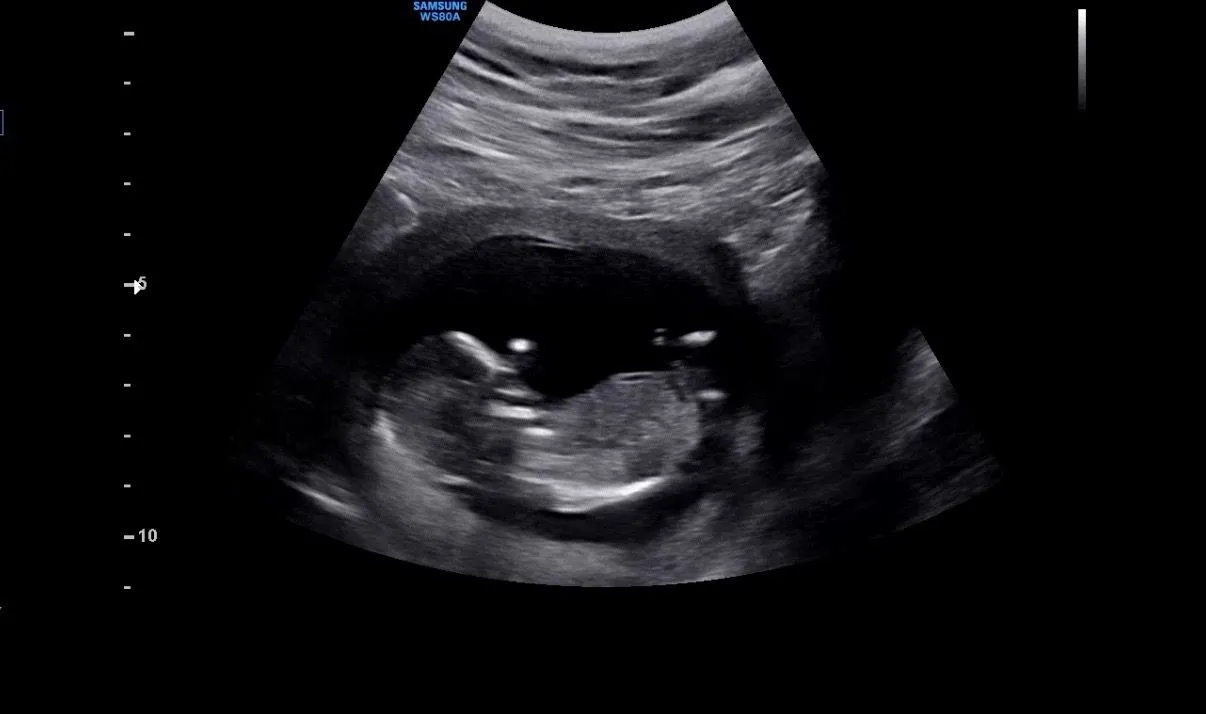 13주3일 각도법봐주세요오 🍼 2