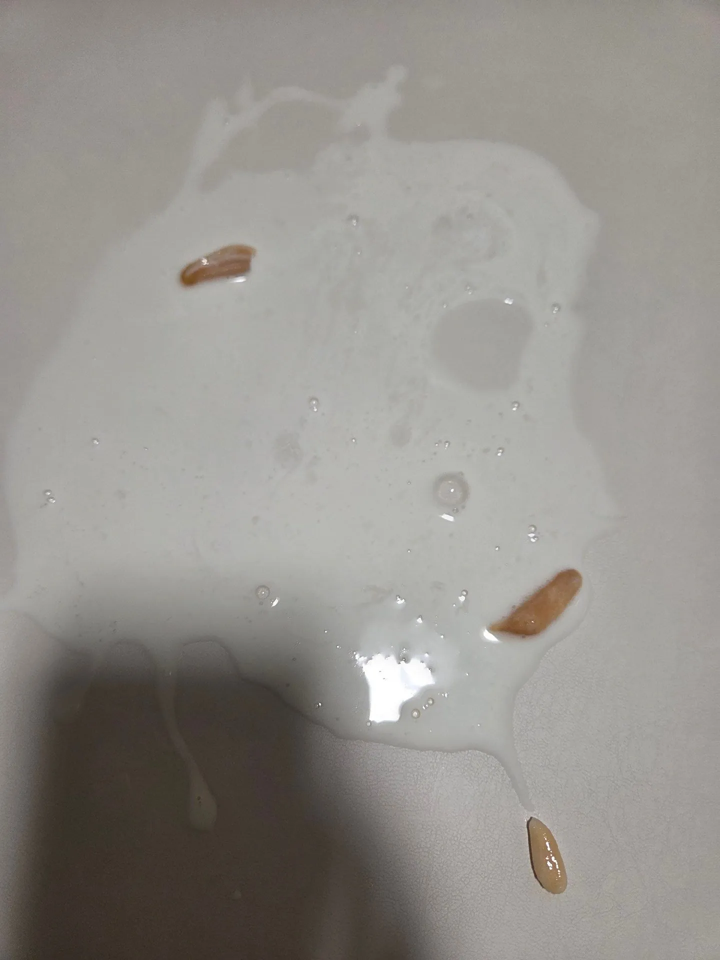7개월 아기 토 이물질(사진첨부)