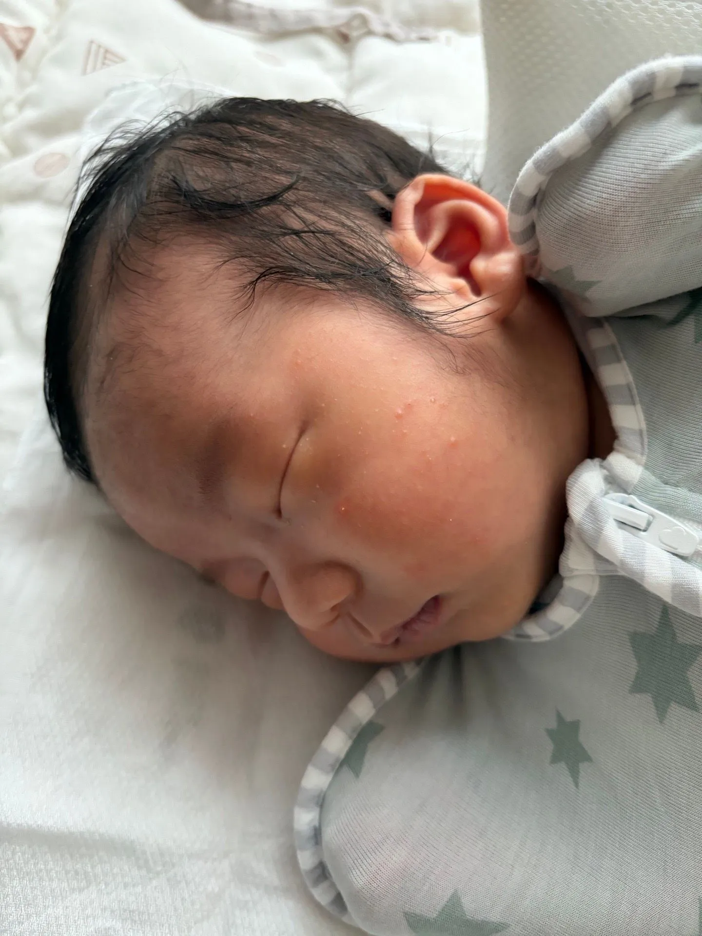 애기 얼굴에 여드름같은게 많이나네요 ㅠㅠ