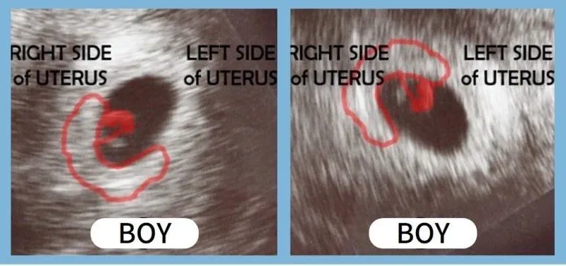 난황 위치로 성별 유추하는 방법도 있었네요 1