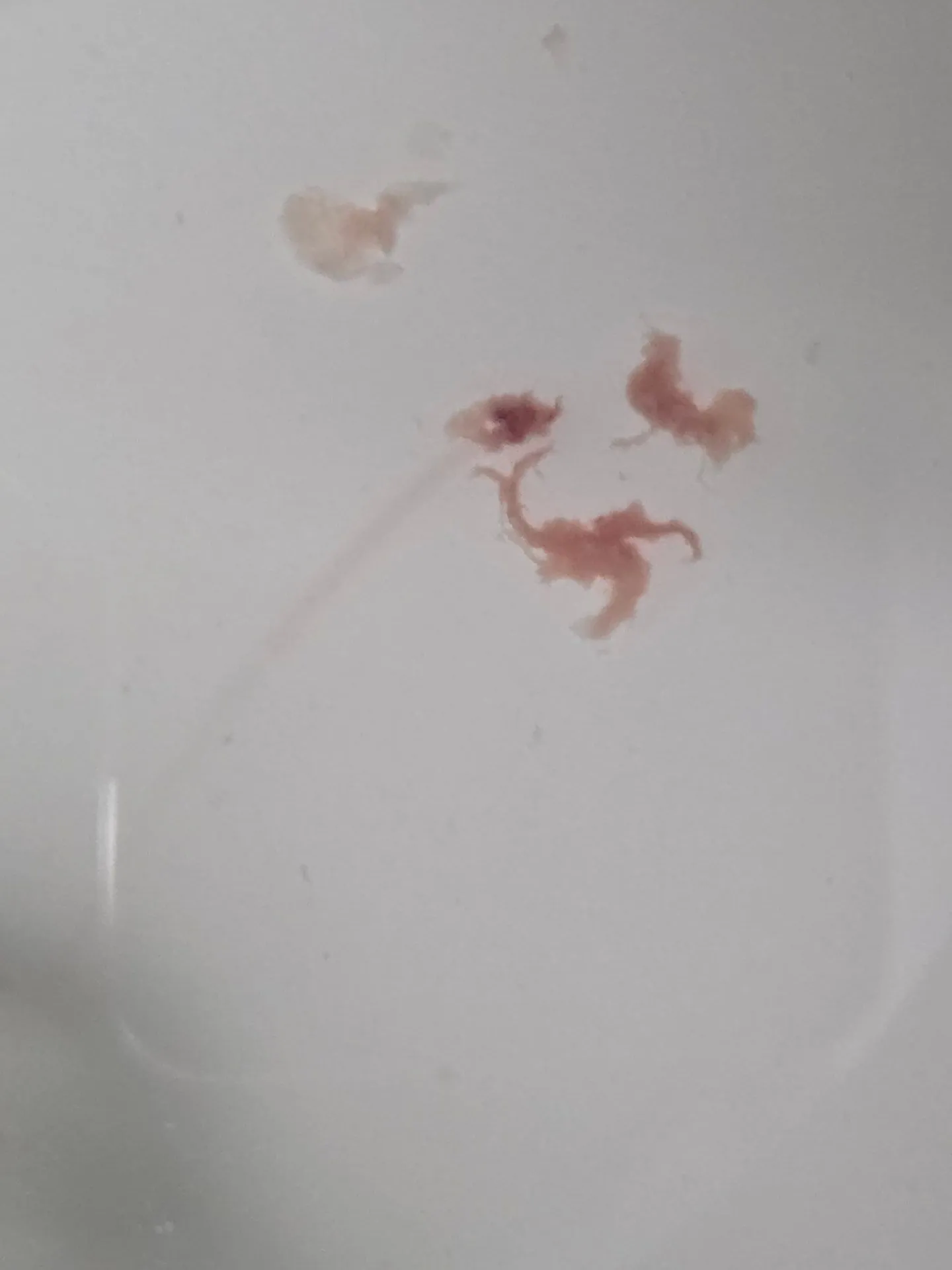 궁금해요 소변보다 이런게 나왔는데 괜찮나요?