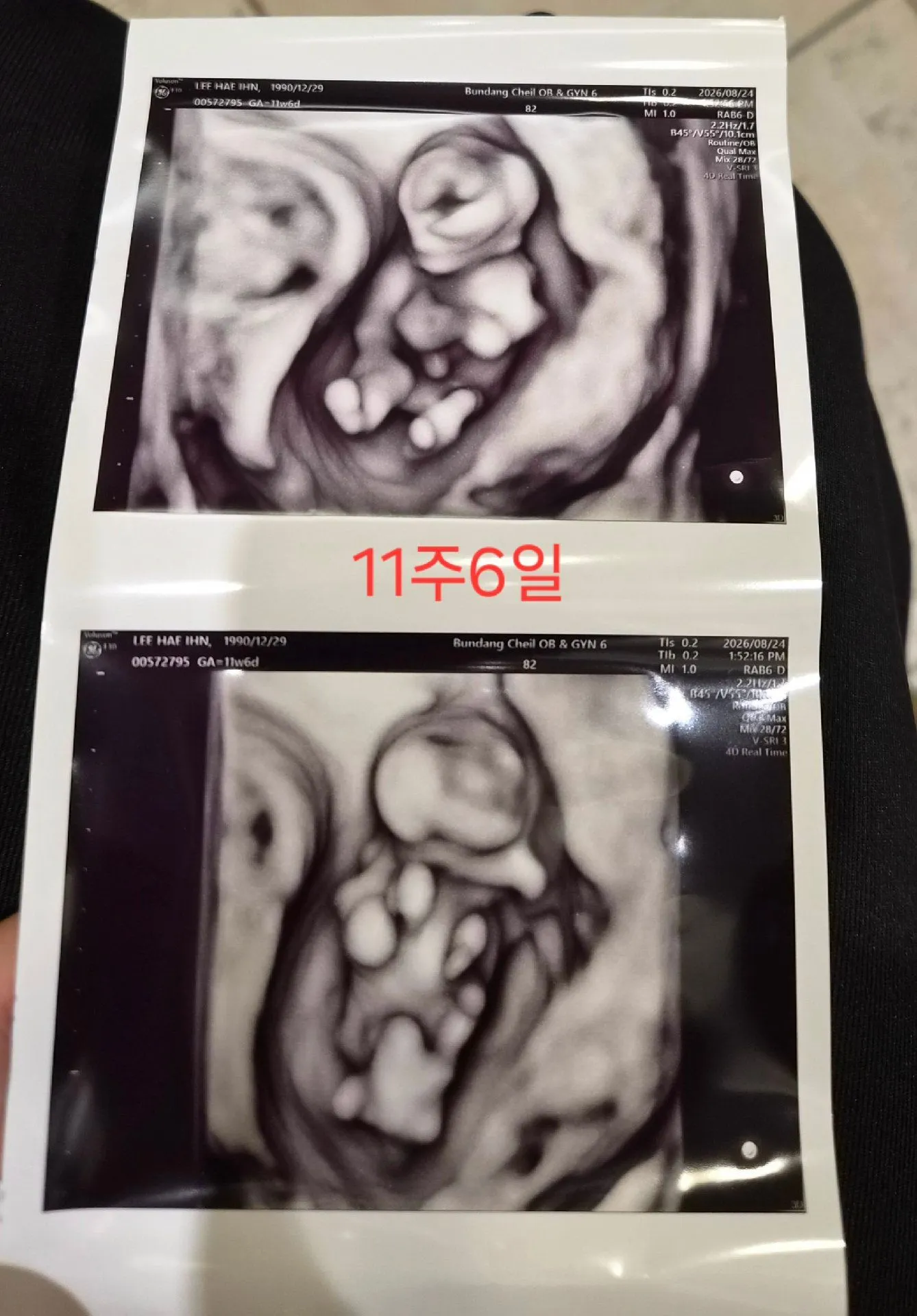 오늘 1차입체 초음파 찍고왔어요~ 2