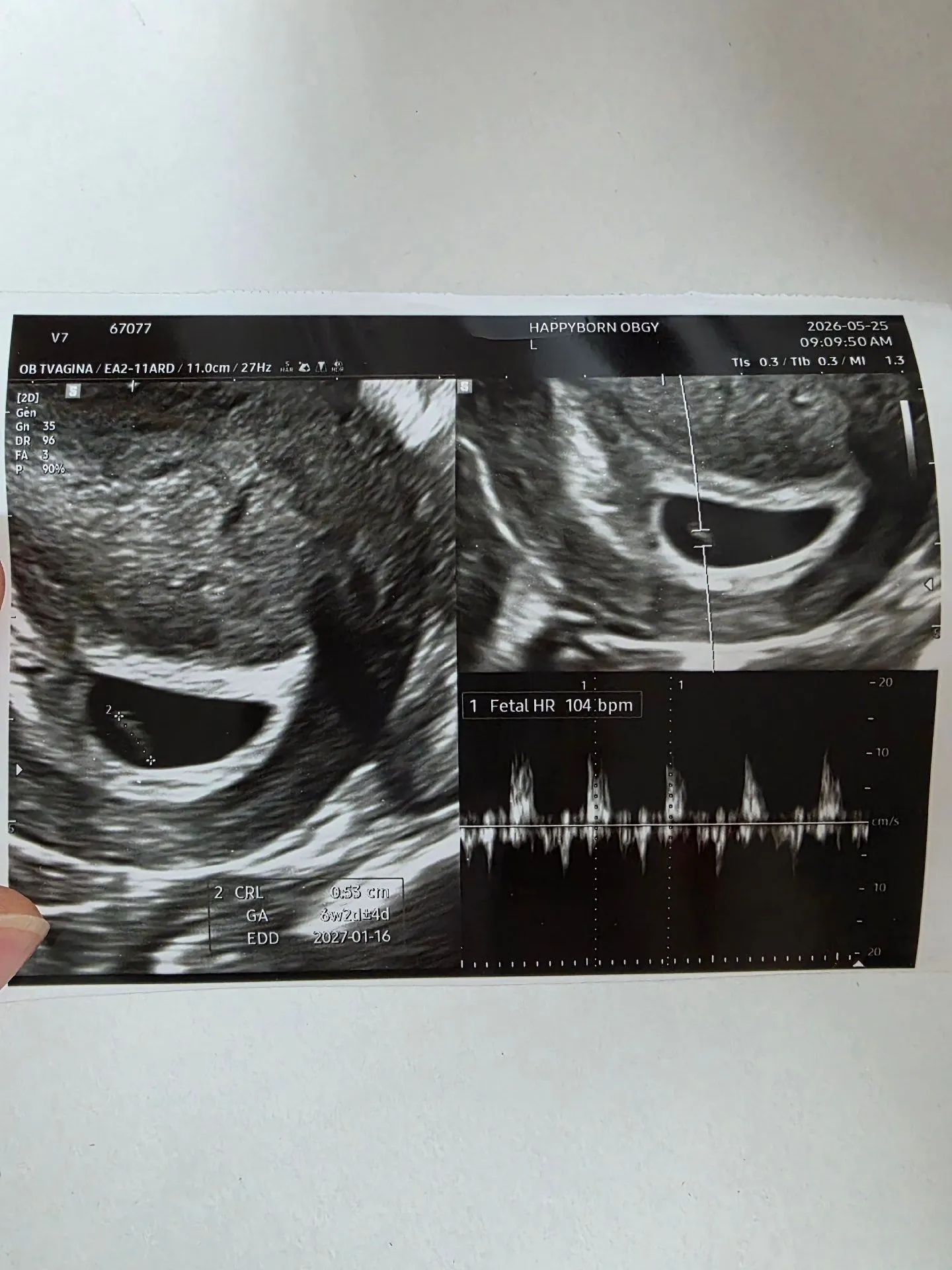 일주일뒤결정..(답변부탁드려요ㅠㅠ) 2