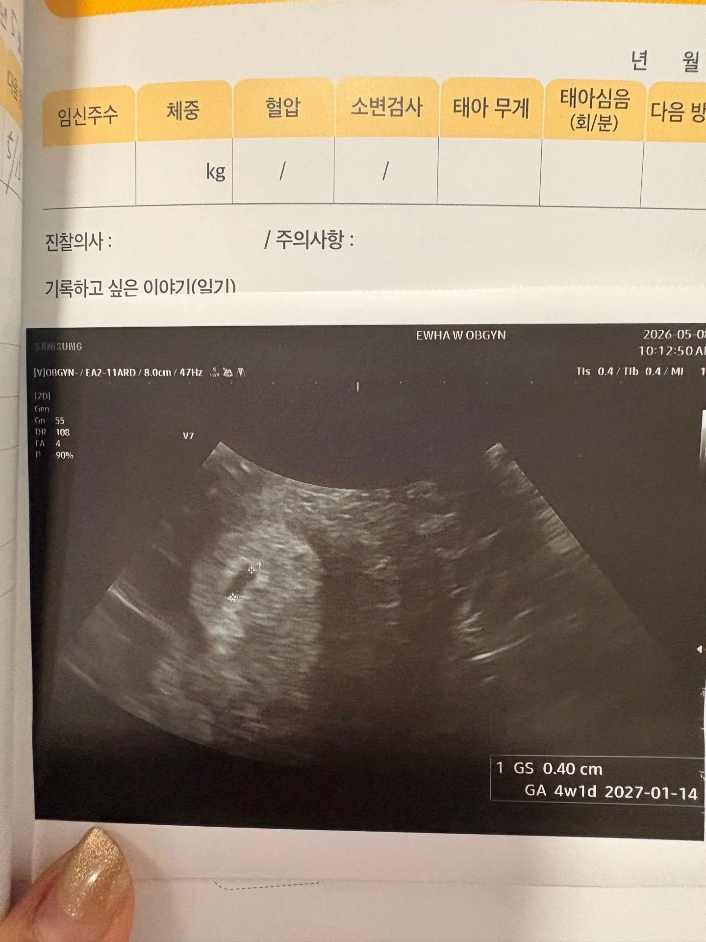 뭣도 모르고 병원 갔는데 이게 아기집인가요? 