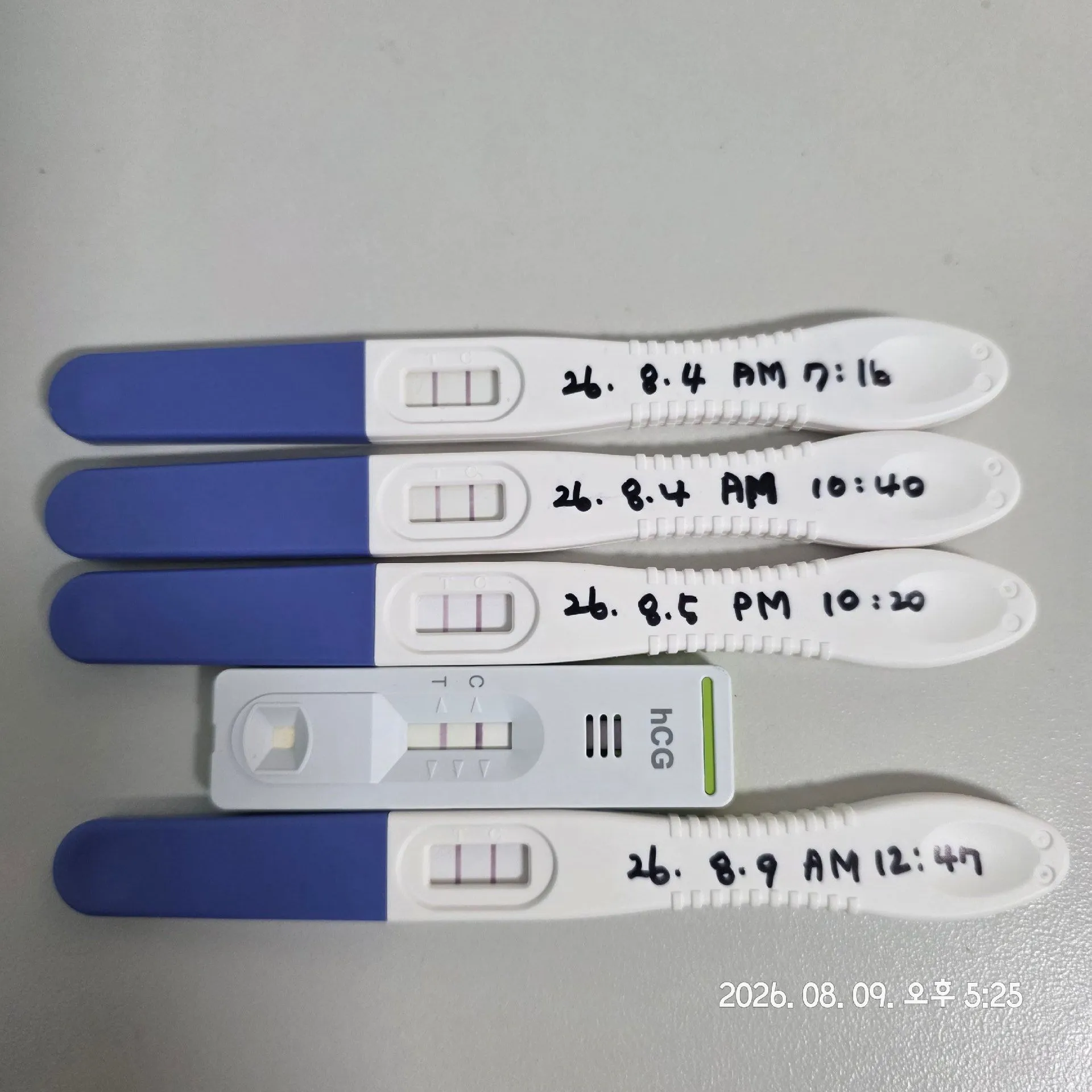 수술 권유 받았어요 2