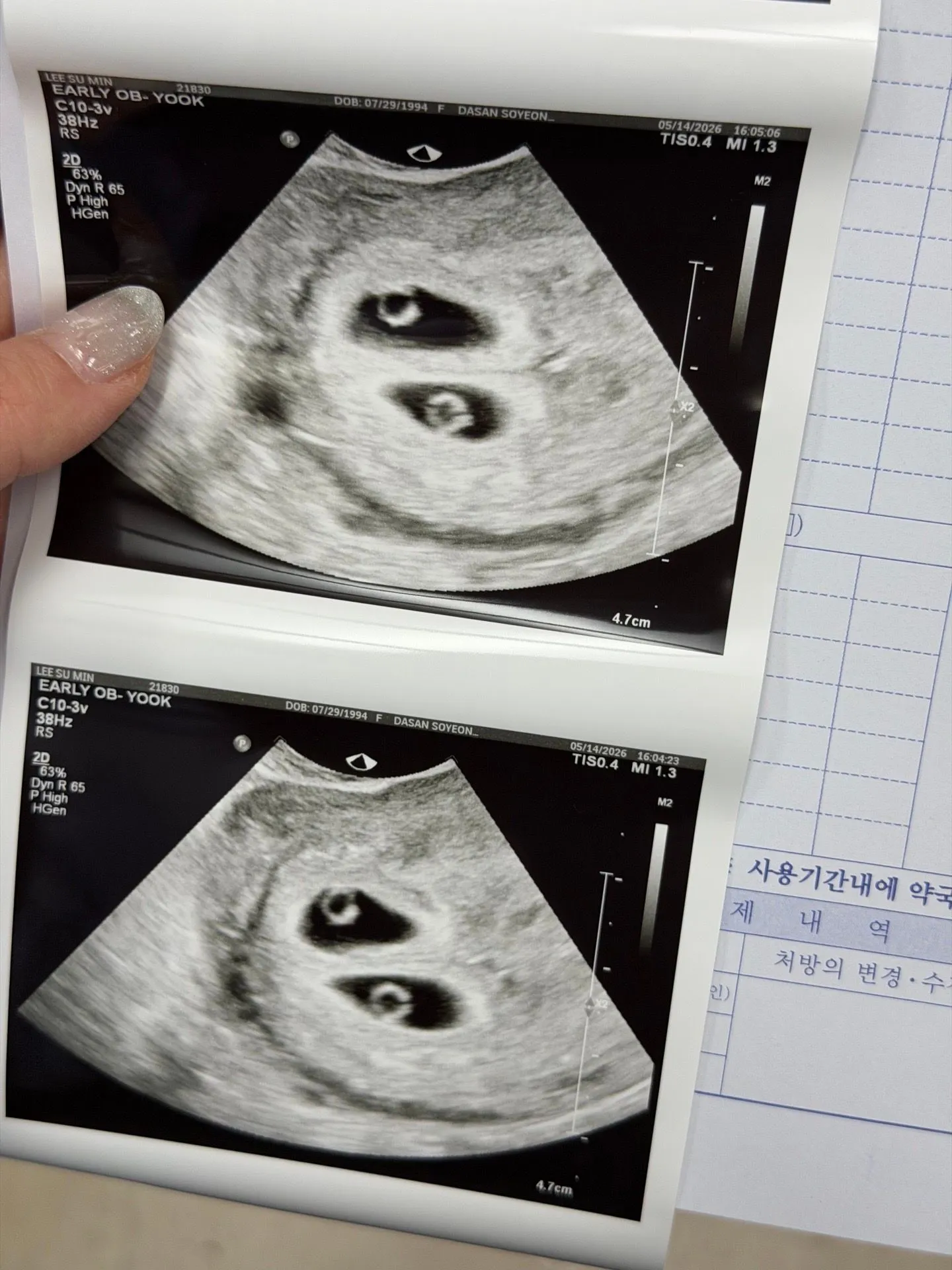 둘째를 계획 했는데 셋째까지!!!
