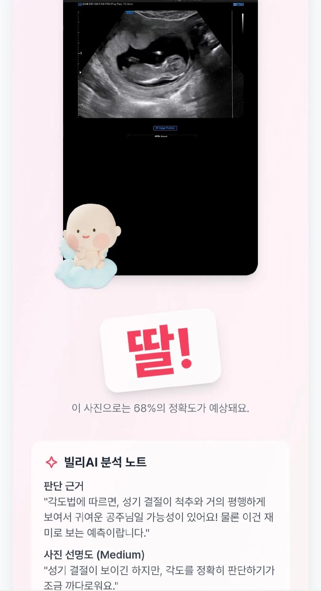홍이맘 딸, 장꾸맘 아들 예측, 과연 성별은ㅠㅠ 2