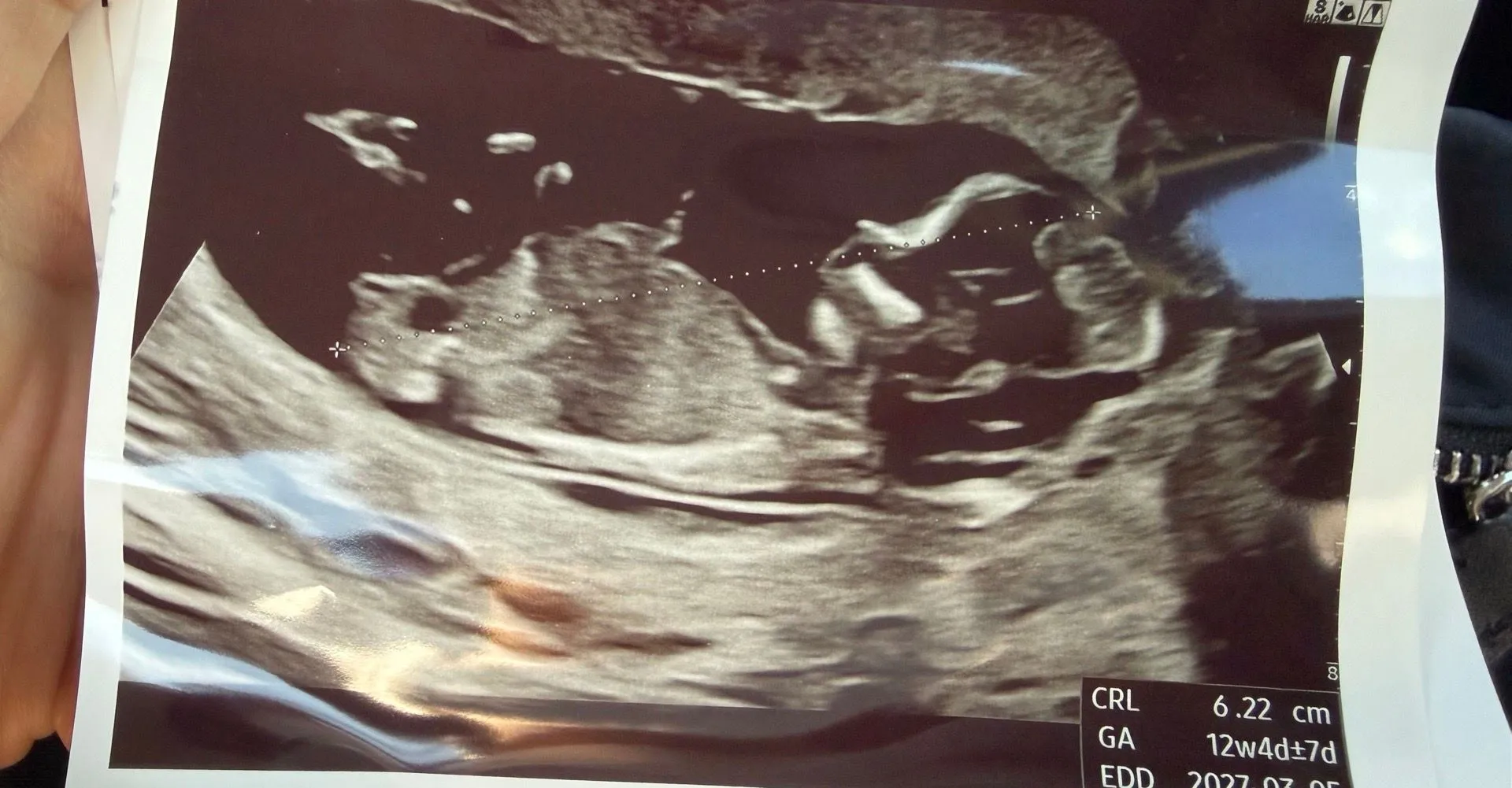 12주3일