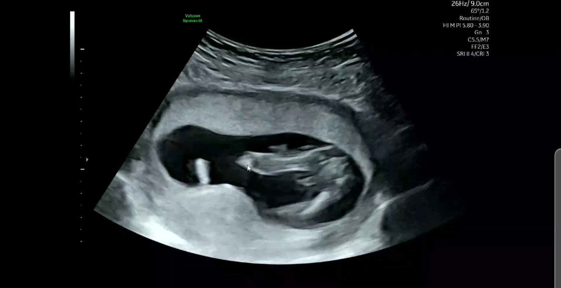 14주 5일 다리사이 한번 함께 봐주세요! 3