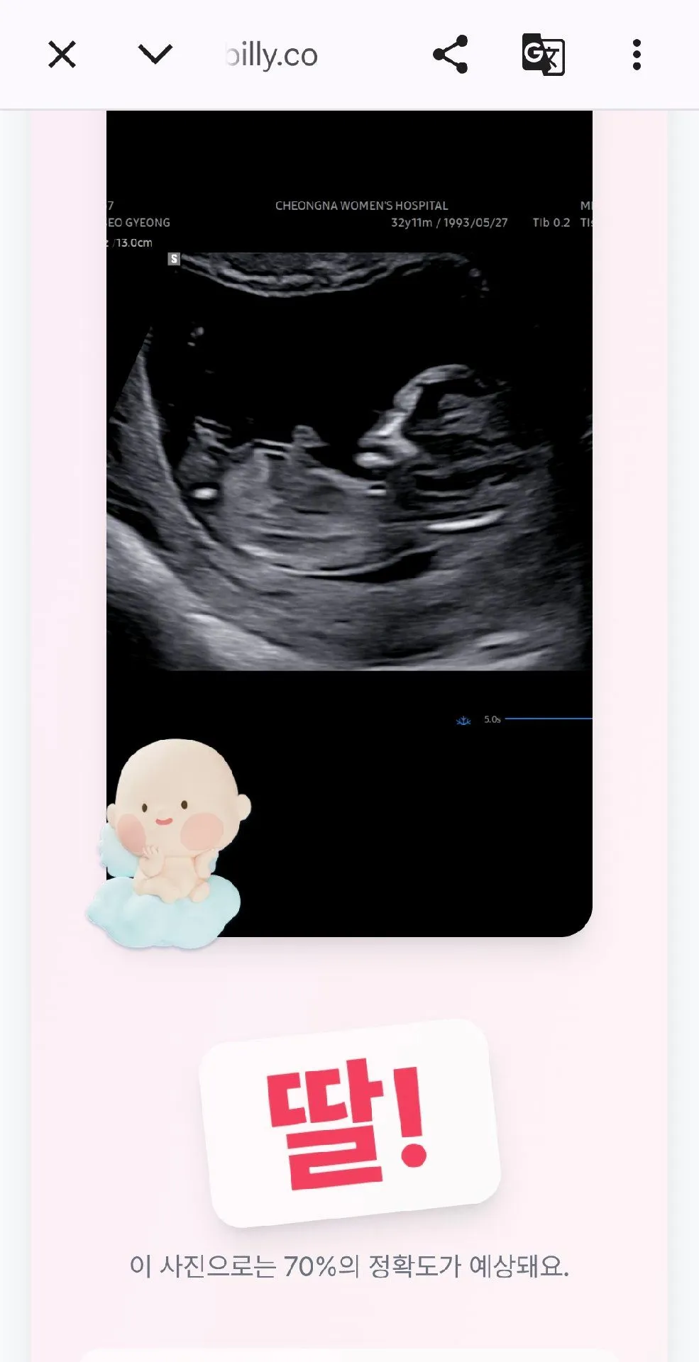 12주차 딸일까요? 아들일까요? 2