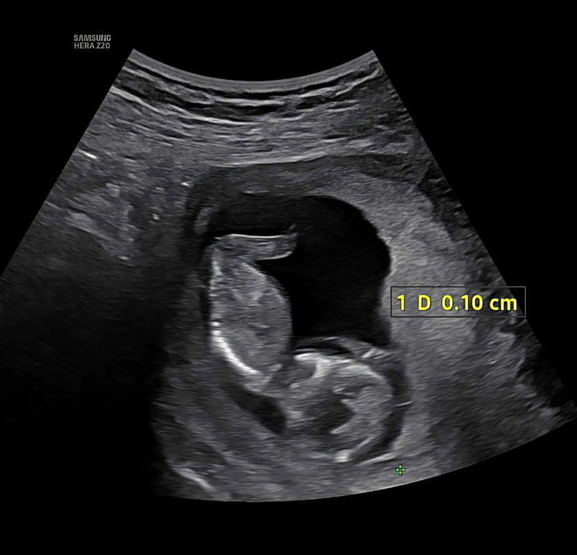 12주 2일 각도법 궁금해요 1