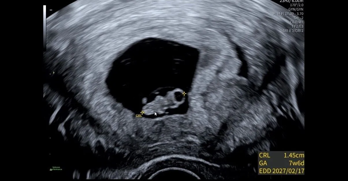 7w6d 