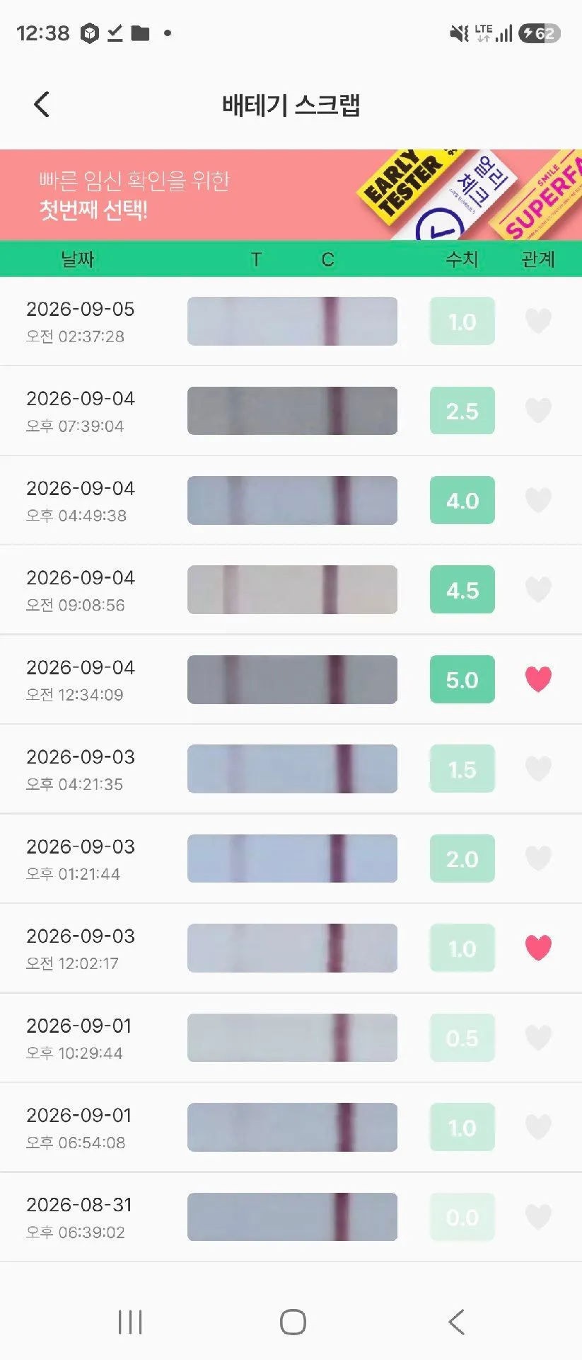 자궁외임신 일까요? 1