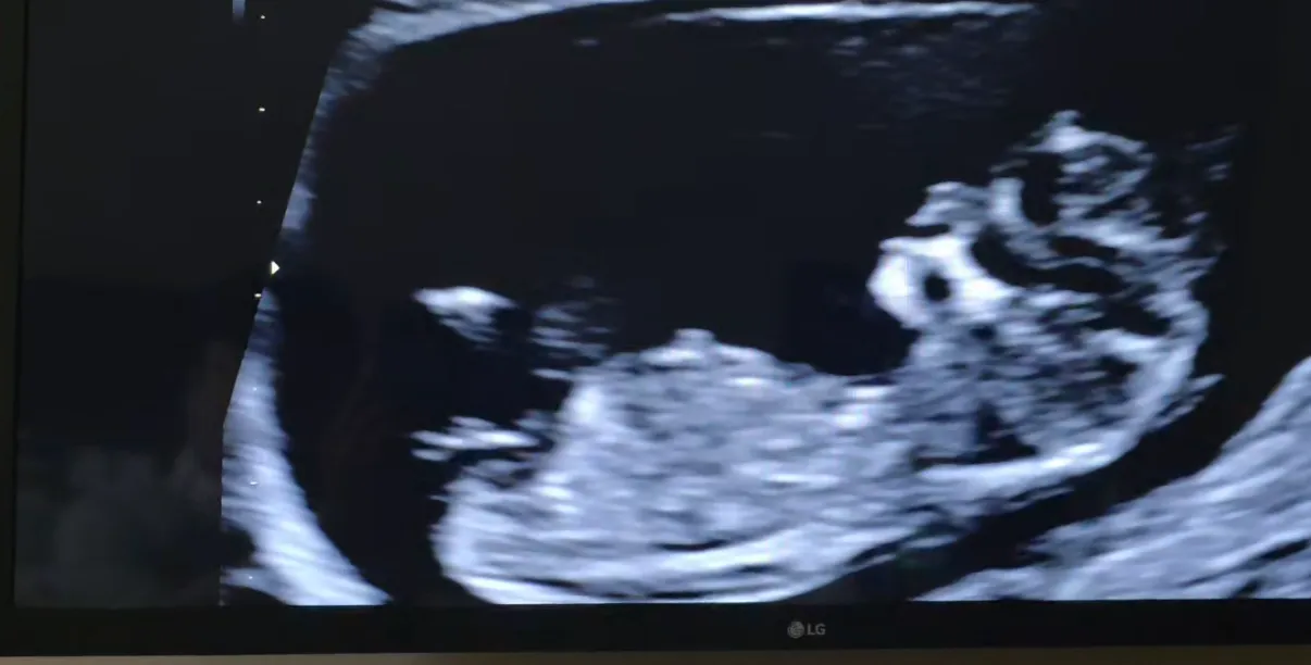 둥이 각도법 봐주세요🙏🏻 3