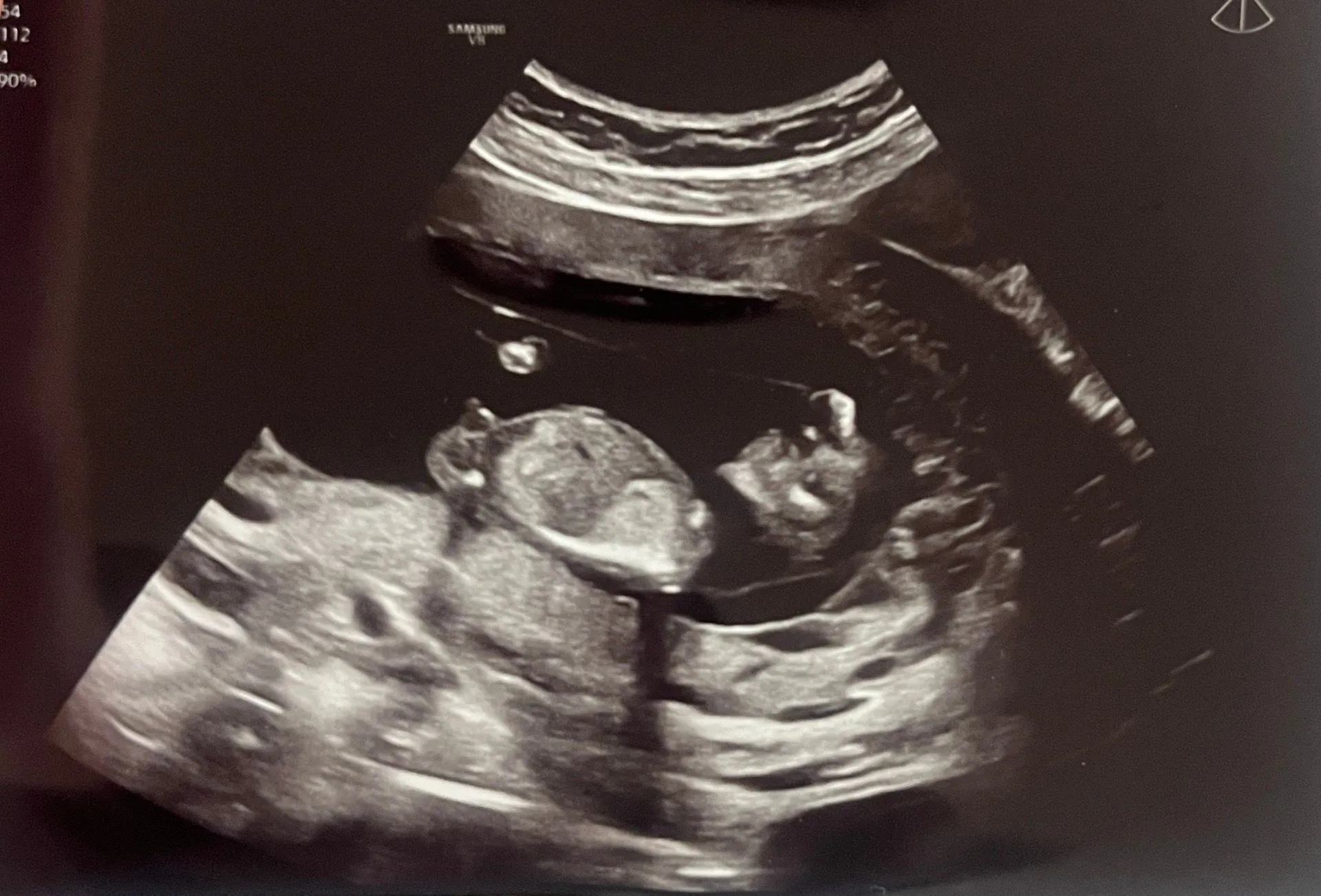 12주 각도법 투표해주세요🍼🩵🩷