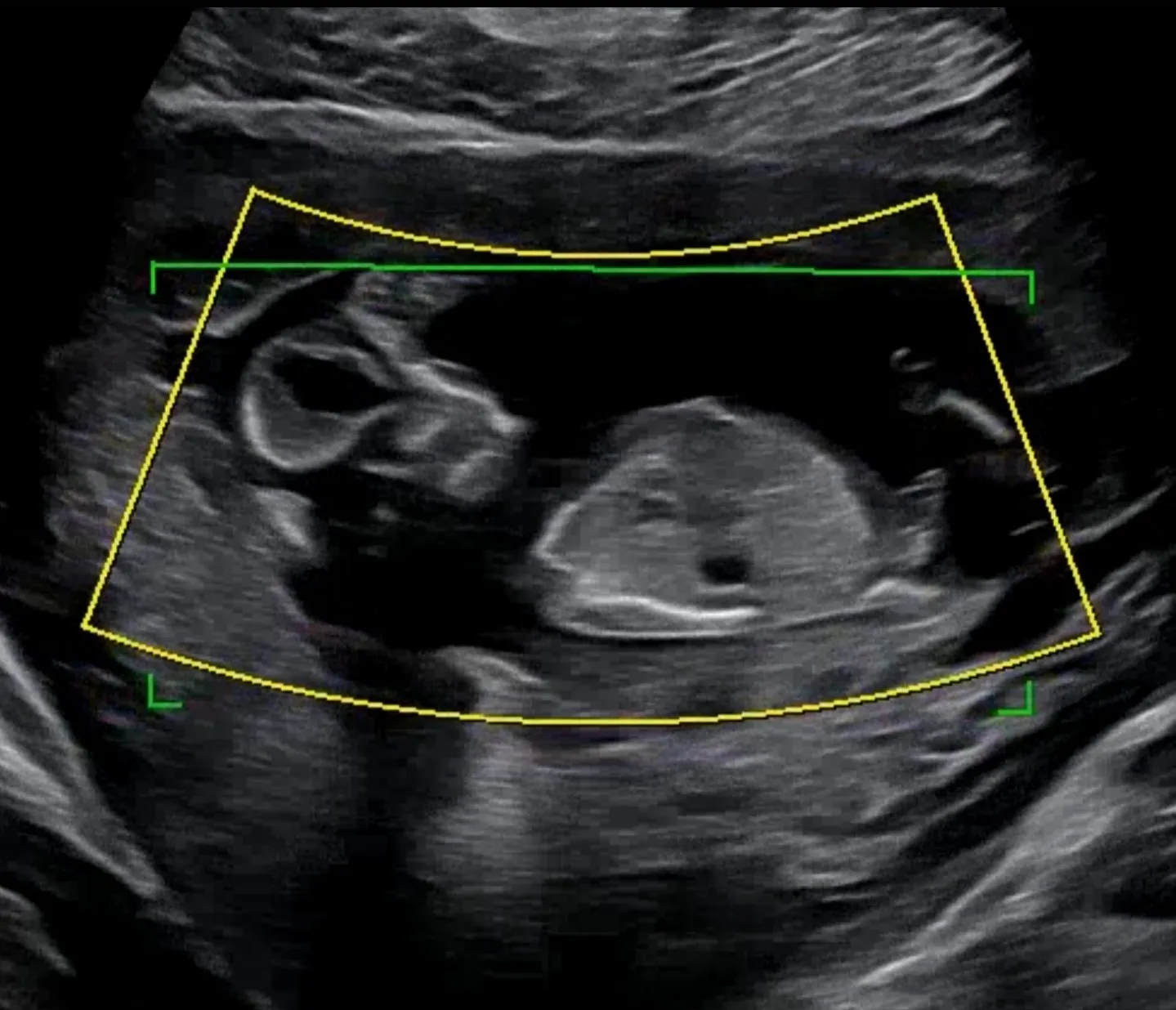 13주차 1일 성별 예측 부탁드려요👶 2