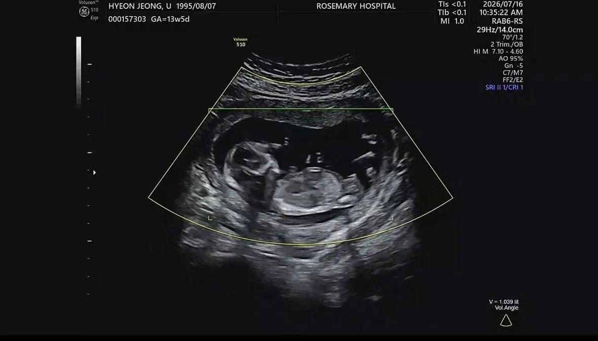 13주 각도법 한번 봐주세용 !!!!! 2