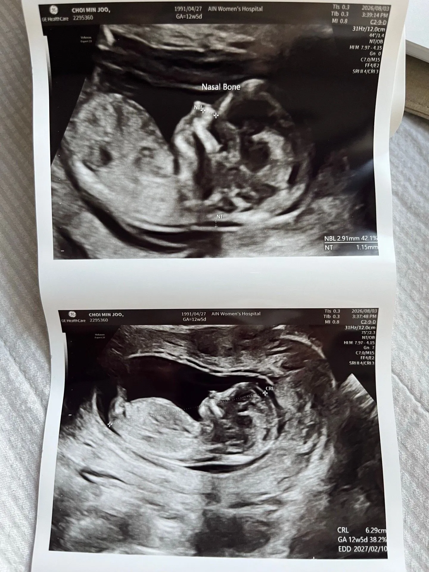 12주차 성별 봐주세요👶🏻😭 3