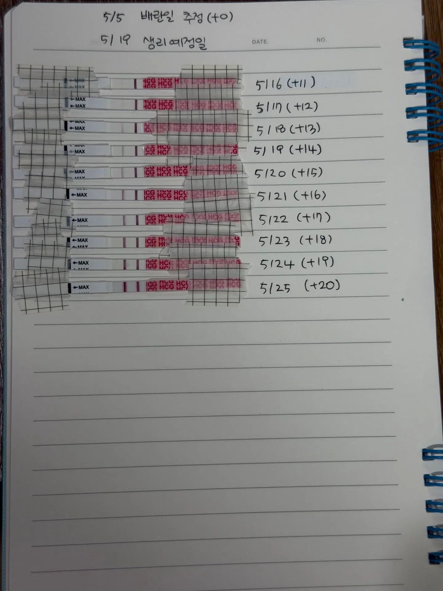 임신 초기 통증 ㅠㅠ 2