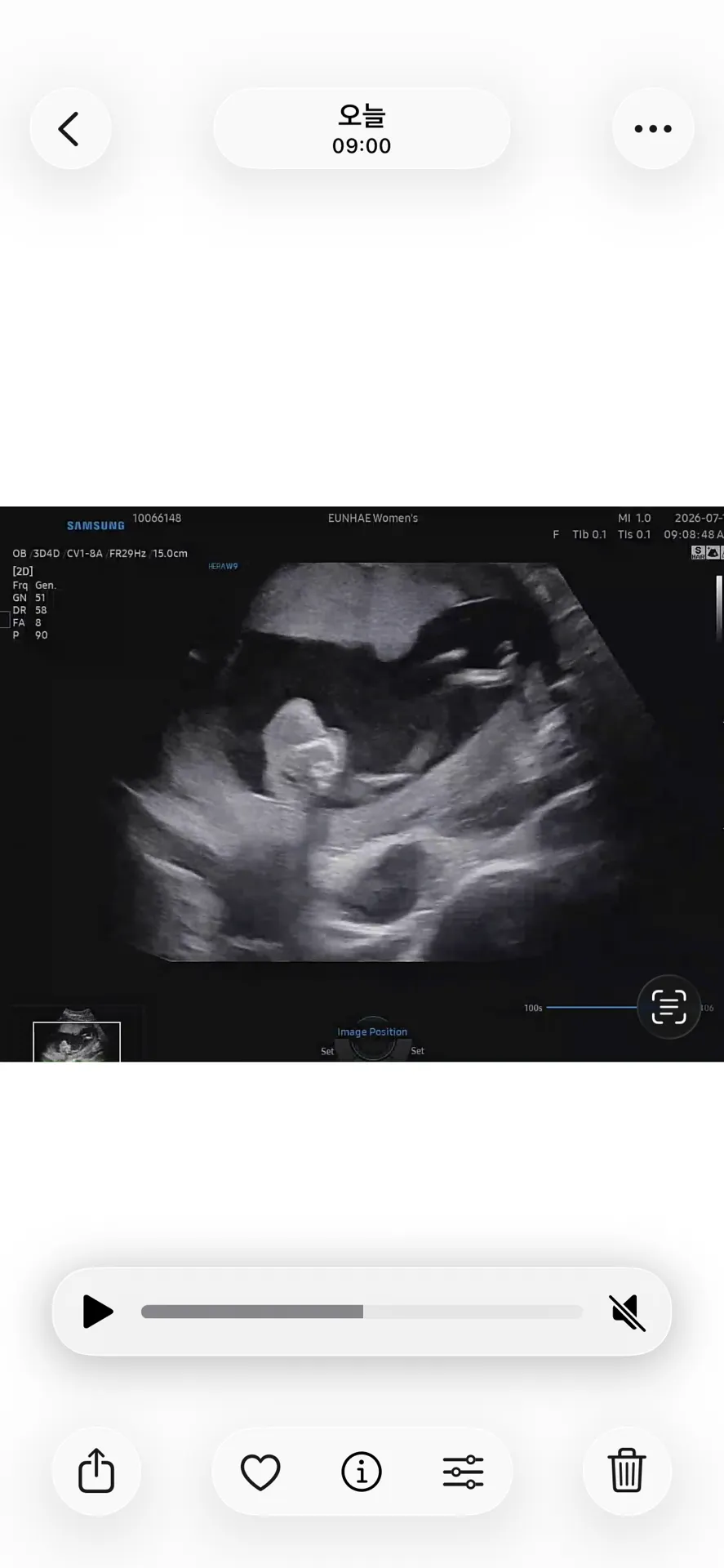 (12주 6일차)와이프랑 같이 1차 기형아검사를 하고 왔는데 대학병원 소견서를 받아왔네요 1