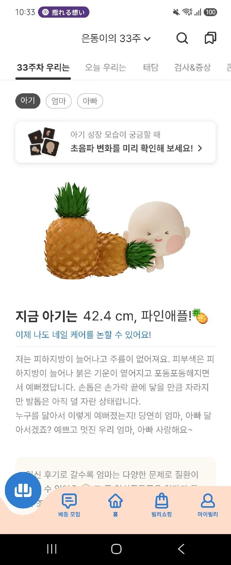 은동이 이제 파인애플이래여😂