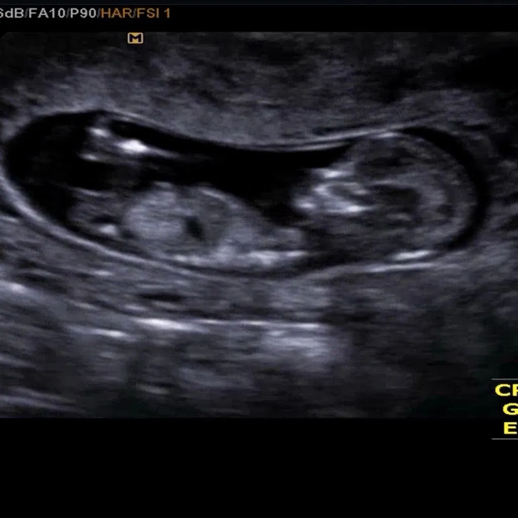 각도법 궁금해여 >< 3