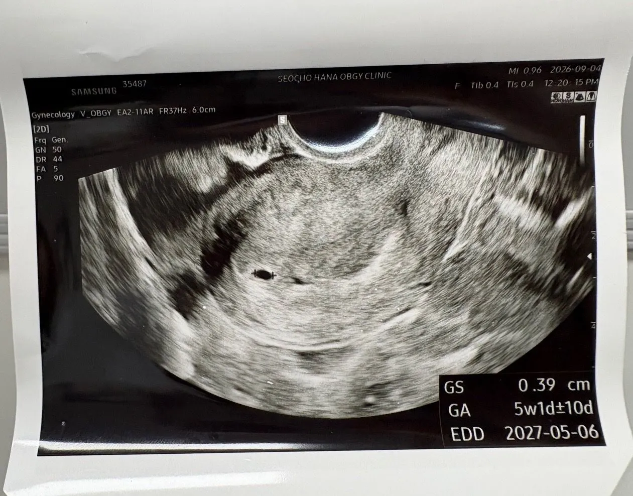 배란16일차 아기집봤어요!! 