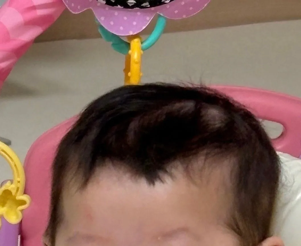 다른 아기들도 이런가요ㅜㅜ 1