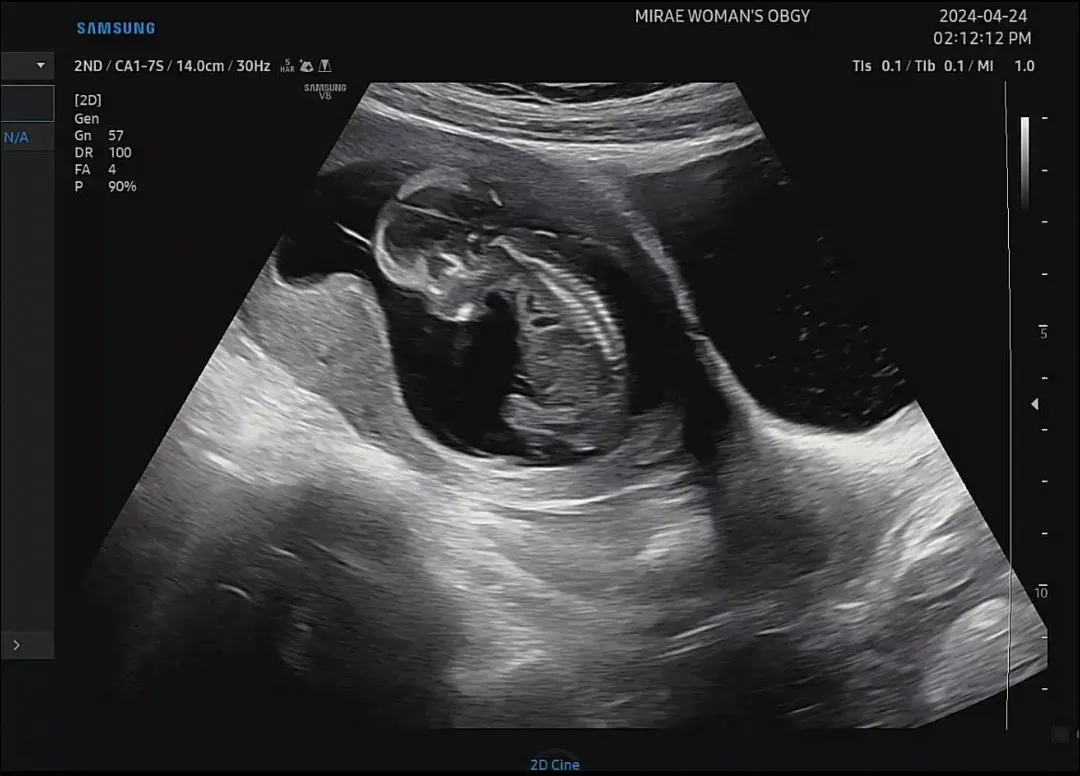 12쥬 5일 👶🏻
