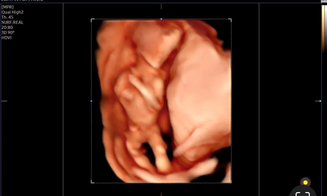 성별 너무 궁금해요ㅠ_ㅠ
