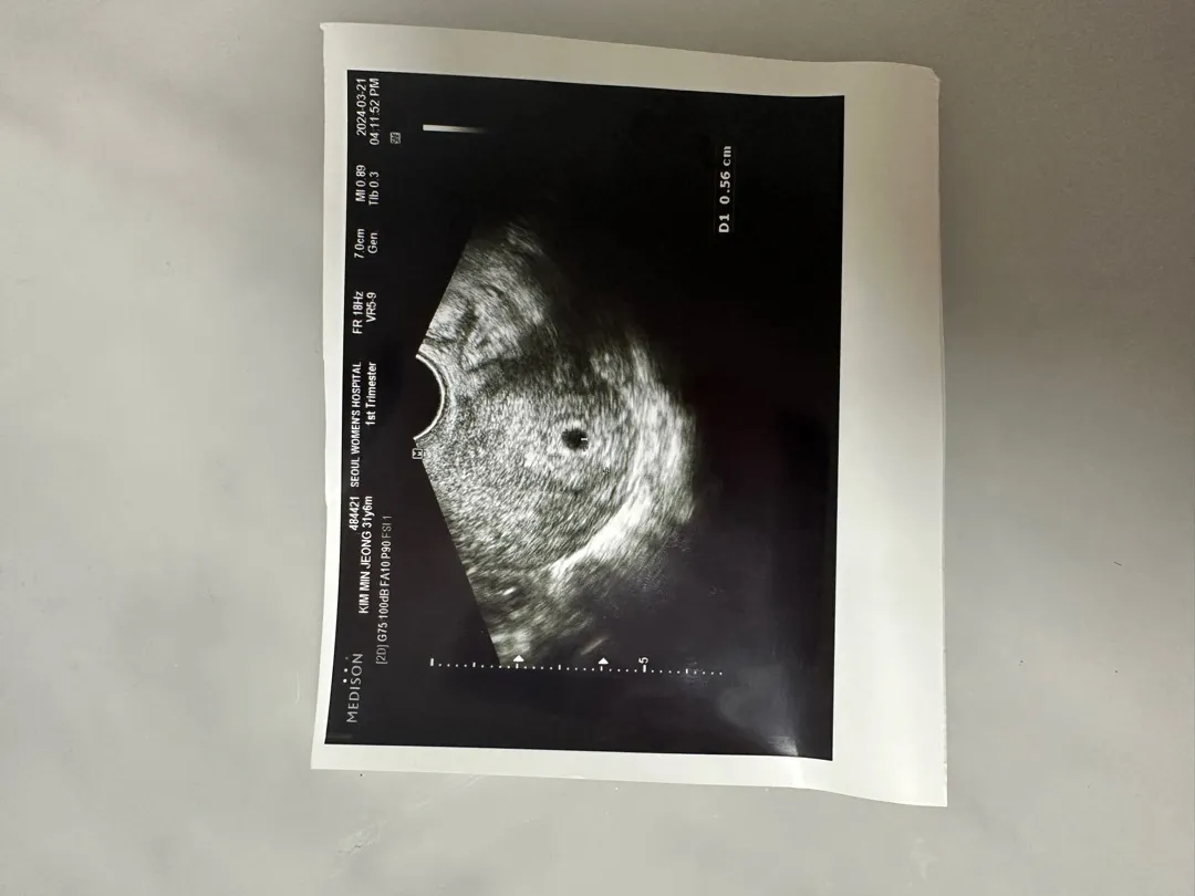 드디어 아기집 보고왔어요 😍
