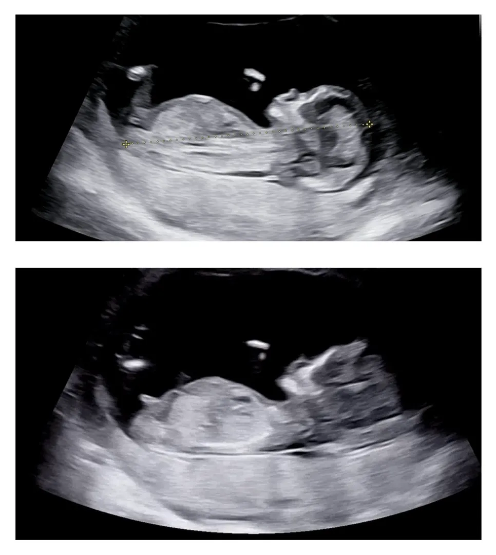12w2d 각도법..👶🏻