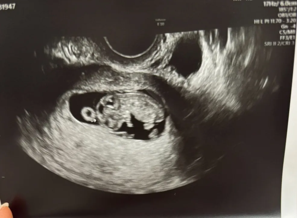 9주3일차 왕애기…뚱뚱이…
