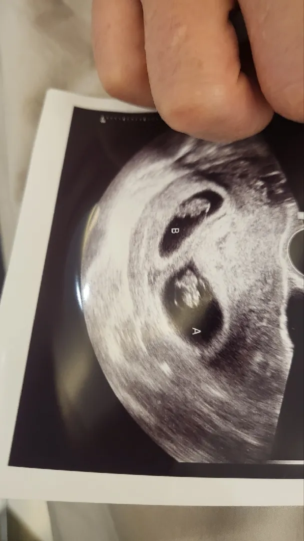 꼬물꼬순이 쌍둥이 칭구 있나요? 