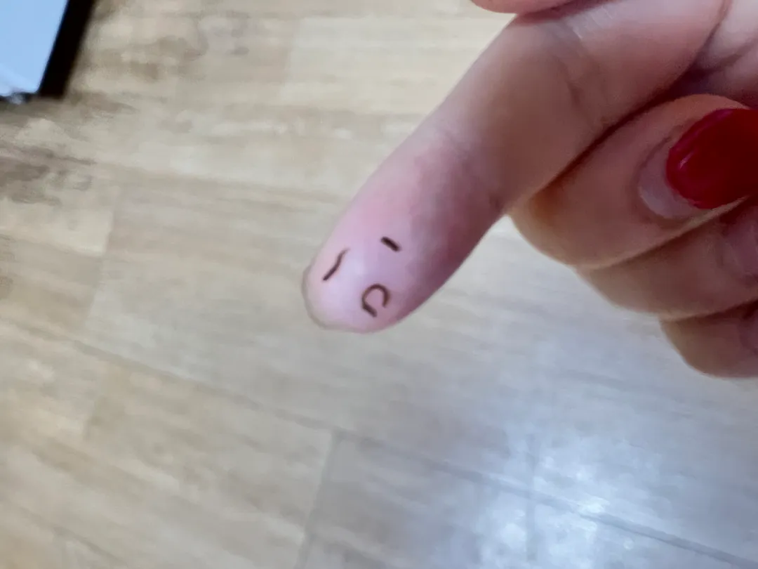 제왕절개후75째염증