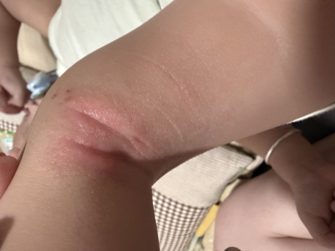 community post image