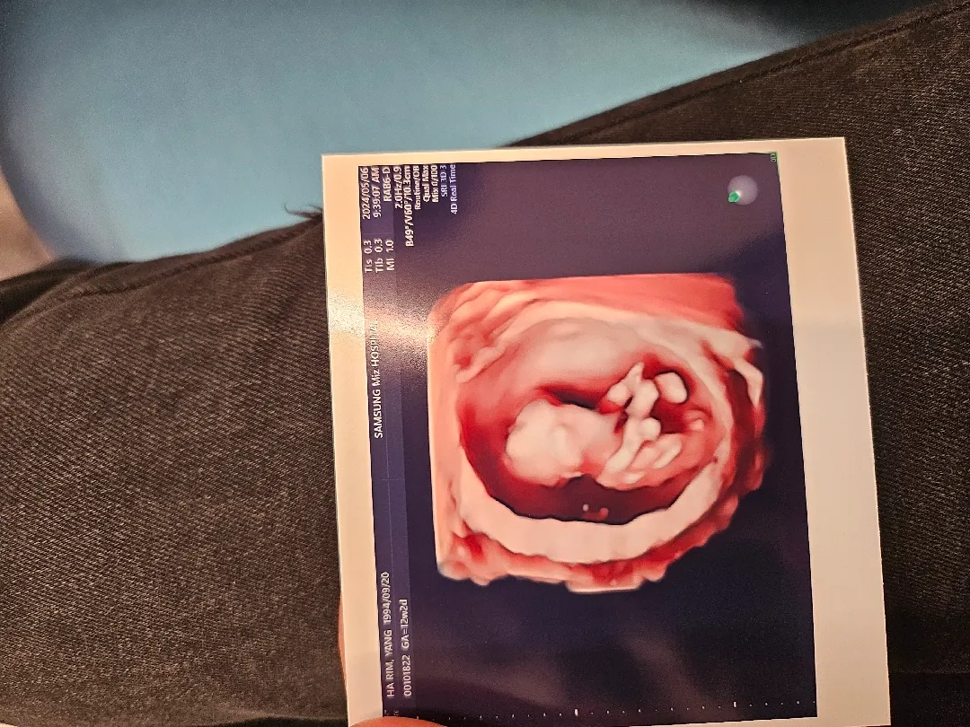 다리 밑에 이거 고추맞죠 ㅋㅋ