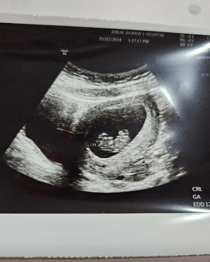 좀 더 자란 젤리곰 보고 왔어요옹!!