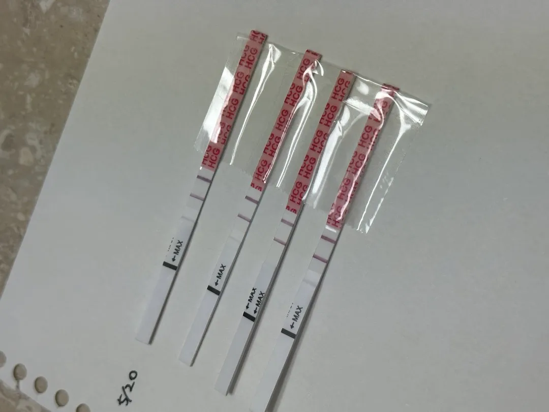 역전없이 아기집 보신분 계실까요? 