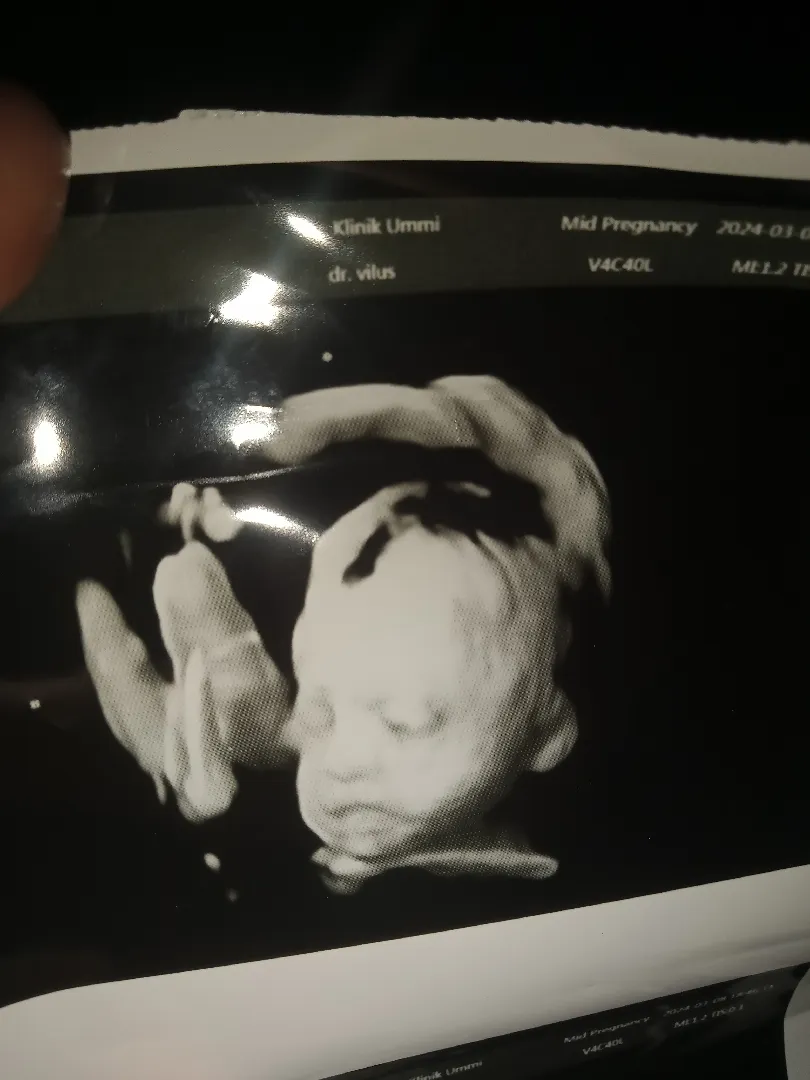 Baby ayoona