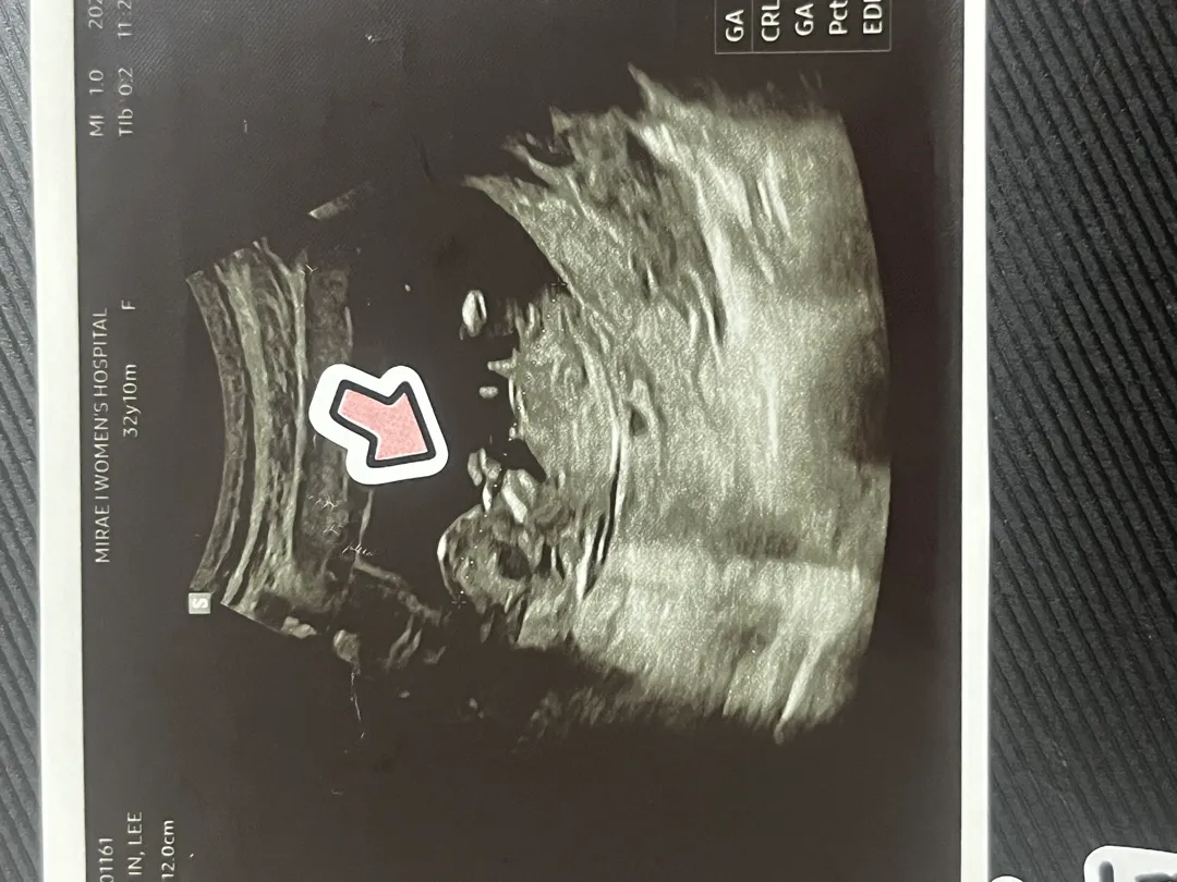 성별간섭좀해주세요ㅠㅠㅠㅠ