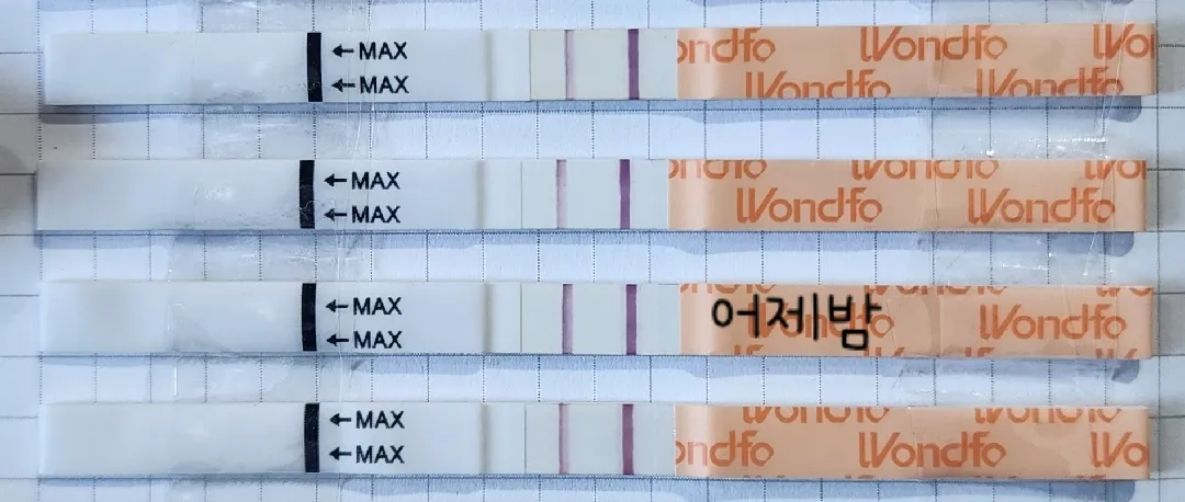 극초기 임테기 소변농도