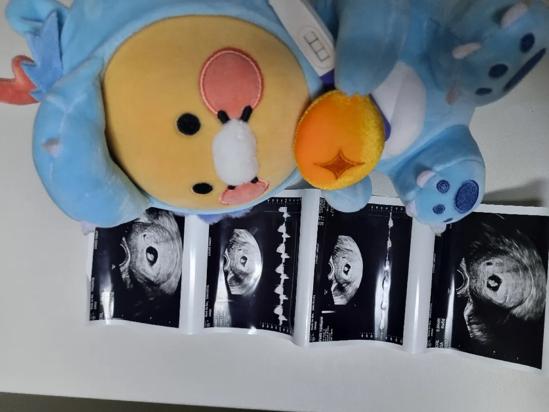 안녕하세요 보물이 아빠입니다