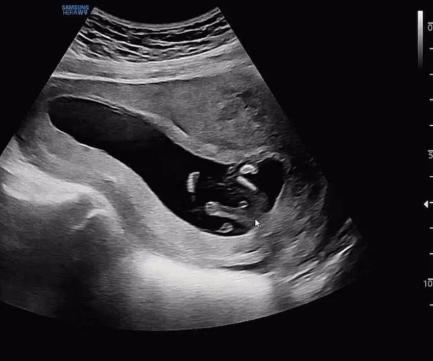 저기 보이는건
