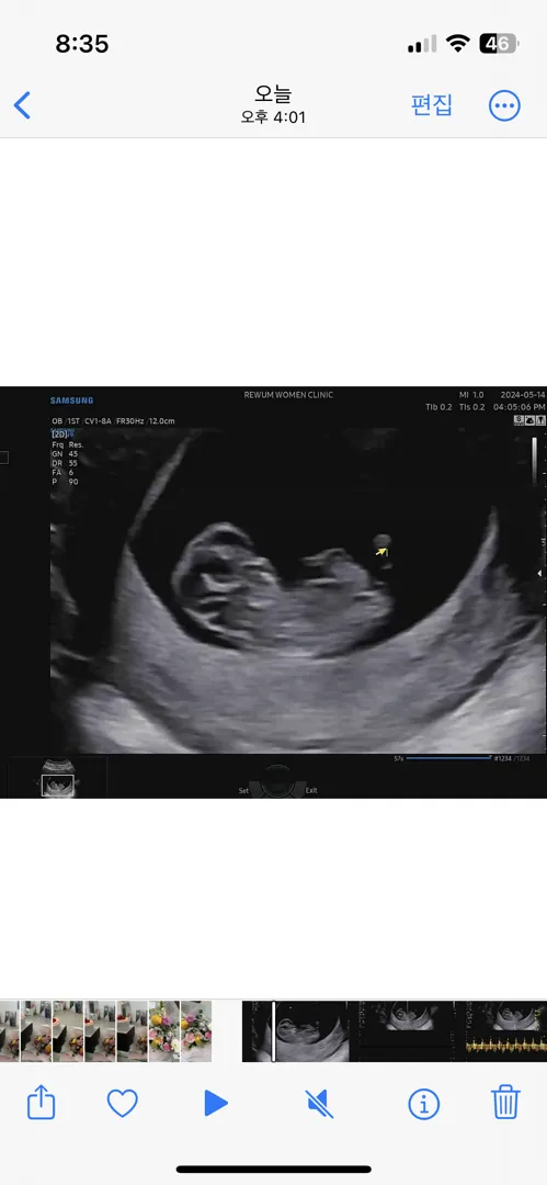 9주6일차 초음파보고왔어요^^