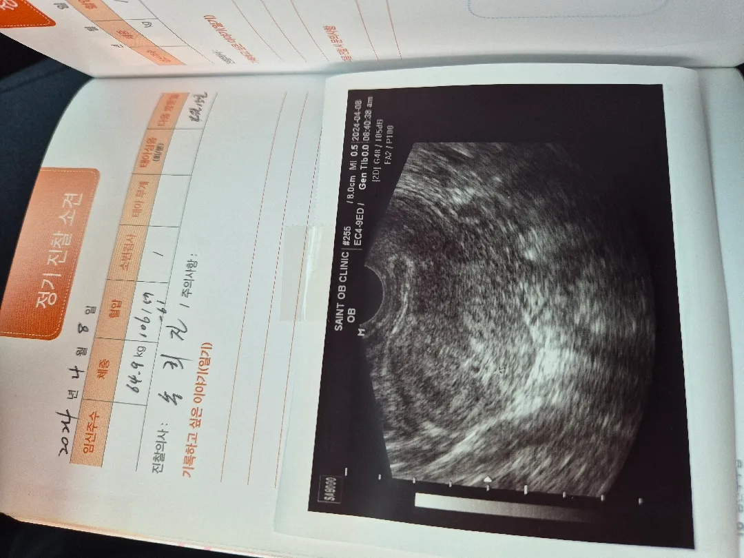4주3일 초음파^^♡