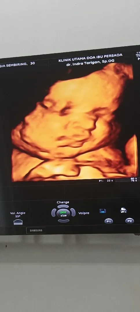 36 week