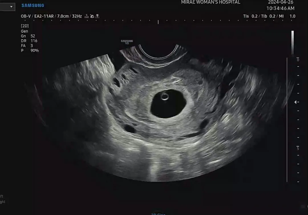 초음파보고왔오용👶🏻 
